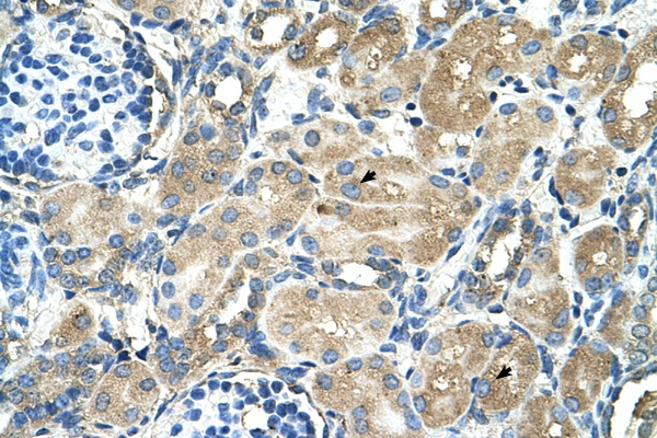 TM9SF1 Antibody - TM9SF1 antibody ARP44685_T100-NP_006396-TM9SF1(transmembrane 9 superfamily member 1) Antibody IHC of formalin-fixed, paraffin-embedded human Kidney. Positive label: Epithelial cells of renal tubule indicated with arrows. Antibody concentration 4-8 ug/ml. Magnification 400X.  This image was taken for the unconjugated form of this product. Other forms have not been tested.