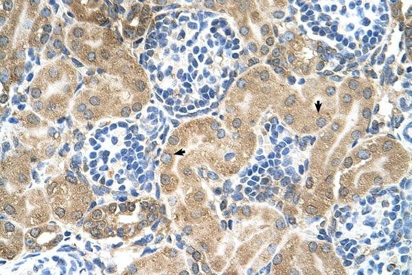 TM9SF1 Antibody - TM9SF1 antibody ARP44683_T100-NP_006396-TM9SF1(transmembrane 9 superfamily member 1) Antibody IHC of formalin-fixed, paraffin-embedded human Kidney. Positive label: Epithelial cells of renal tubule indicated with arrows. Antibody concentration 4-8 ug/ml. Magnification 400X.  This image was taken for the unconjugated form of this product. Other forms have not been tested.