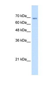 TM9SF1 Antibody - TM9SF1 antibody ARP44683_T100-NP_006396-TM9SF1(transmembrane 9 superfamily member 1) Antibody Western blot of Jurkat lysate.  This image was taken for the unconjugated form of this product. Other forms have not been tested.