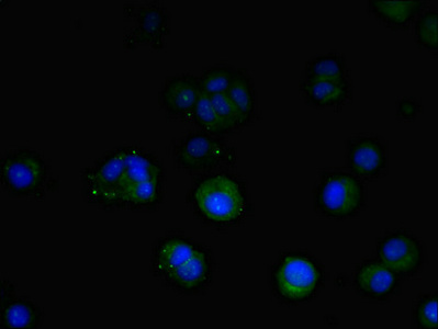 TM9SF1 Antibody - Immunofluorescent analysis of mcf-7 cells diluted at 1:100 and Alexa Fluor 488-congugated AffiniPure Goat Anti-Rabbit IgG(H+L)