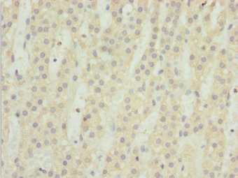 TM9SF1 Antibody - Immunohistochemistry of paraffin-embedded human adrenal gland tissue at dilution 1:100