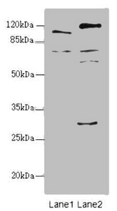 TM9SF1 Antibody - Western blot All Lanes:TM9SF1 antibody at 2.18ug/ml Lane 1 : Mouse liver tissue Lane 2 : Mouse kidney tissue Secondary Goat polyclonal to Rabbit IgG at 1/10000 dilution Predicted band size: 69,56 kDa Observed band size: 69,110,59,28 kDa