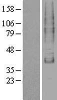 TM9SF1 Protein - Western validation with an anti-DDK antibody * L: Control HEK293 lysate R: Over-expression lysate