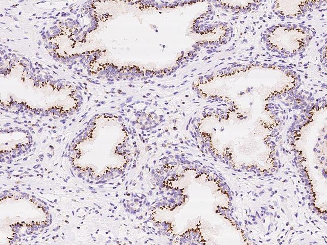TM9SF2 Antibody - Immunochemical staining of human TM9SF2 in human prostate with rabbit polyclonal antibody at 1:100 dilution, formalin-fixed paraffin embedded sections.
