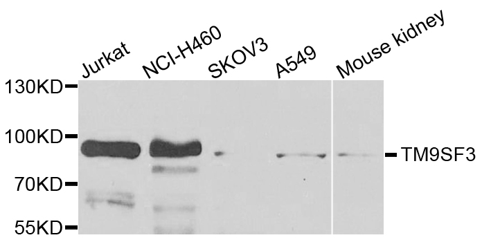 TM9SF3 Antibody - Western blot blot of extracts of various cells, using TM9SF3 antibody.