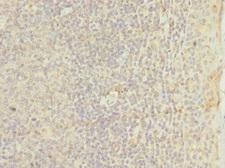 TM9SF3 Antibody - Immunohistochemistry of paraffin-embedded human tonsil tissue at dilution 1:100