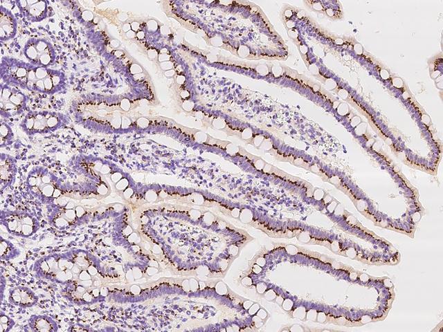 TM9SF3 Antibody - Immunochemical staining of human TM9SF3 in human duodenum with rabbit polyclonal antibody at 1:100 dilution, formalin-fixed paraffin embedded sections.