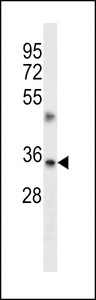 TMBIM1 Antibody - TMBIM1 Antibody western blot of A549 cell line lysates (35 ug/lane). The TMBIM1 antibody detected the TMBIM1 protein (arrow).