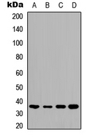 TMBIM1 Antibody - Western blot analysis of TMBIM1 expression in HeLa (A); HepG2 (B); mouse brain (C); rat kidney (D) whole cell lysates.