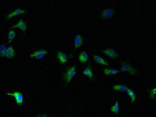 TMBIM1 Antibody - Immunofluorescent analysis of U251 cells using TMBIM1 Antibody at dilution of 1:100 and Alexa Fluor 488-congugated AffiniPure Goat Anti-Rabbit IgG(H+L)
