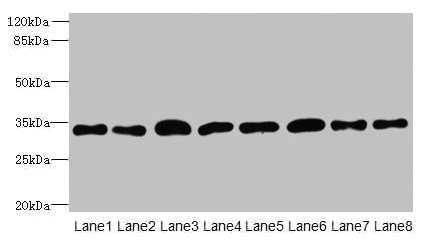 TMBIM1 Antibody - Western blot All lanes: TMBIM1 antibody at 8µg/ml Lane 1: U251 whole cell lysate Lane 2: K562 whole cell lysate Lane 3: A549 whole cell lysate Lane 4: MCF-7 whole cell lysate Lane 5: Mouse lung tissue Lane 6: Mouse liver tissue Lane 7: Mouse kidney tissue Lane 8: Human placenta tissue Secondary Goat polyclonal to rabbit IgG at 1/10000 dilution Predicted band size: 35 kDa Observed band size: 35 kDa