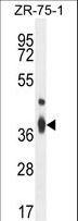 TMBIM4 / GAAP Antibody - TMBIM4 Antibody western blot of ZR-75-1 cell line lysates (35 ug/lane). The TMBIM4 antibody detected the TMBIM4 protein (arrow).