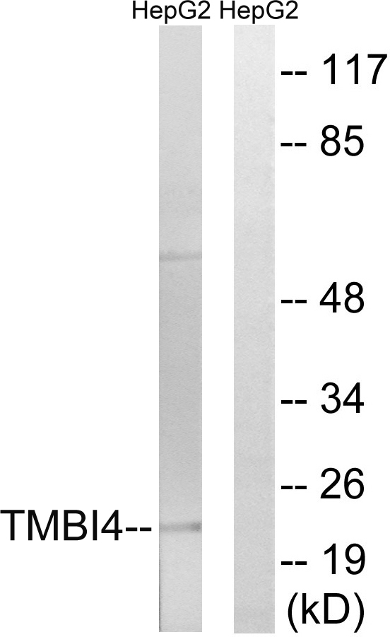 TMBIM4 / GAAP Antibody - Western blot analysis of lysates from HepG2 cells, using TMBIM4 Antibody. The lane on the right is blocked with the synthesized peptide.