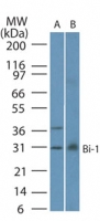 TMBIM6 / Bax Inhibitor 1 Antibody - Western blot of Bi-1 in A) A549 and B) human lung lysate using antibody at 1:1000.