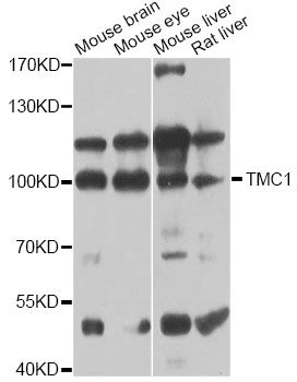 TMC1 Antibody - Western blot analysis of extracts of various cell lines, using TMC1 antibody at 1:1000 dilution. The secondary antibody used was an HRP Goat Anti-Rabbit IgG (H+L) at 1:10000 dilution. Lysates were loaded 25ug per lane and 3% nonfat dry milk in TBST was used for blocking. An ECL Kit was used for detection and the exposure time was 60s.