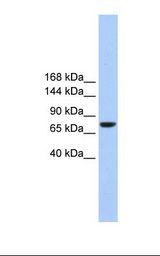 TMC2 Antibody - Hela cell lysate. Antibody concentration: 1.0 ug/ml. Gel concentration: 6%-18%.  This image was taken for the unconjugated form of this product. Other forms have not been tested.
