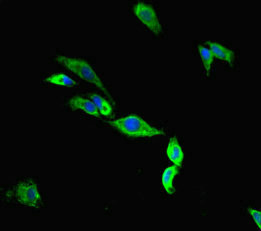 TMC2 Antibody - Immunofluorescent analysis of Hela cells diluted at 1:100 and Alexa Fluor 488-congugated AffiniPure Goat Anti-Rabbit IgG(H+L)