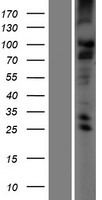 TMC2 Protein - Western validation with an anti-DDK antibody * L: Control HEK293 lysate R: Over-expression lysate