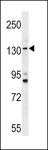 TMC5 Antibody - TMC5 Antibody western blot of HL-60 cell line lysates (35 ug/lane). The TMC5 antibody detected the TMC5 protein (arrow).