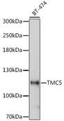 TMC5 Antibody - Western blot analysis of extracts of BT-474 cells using TMC5 Polyclonal Antibody at dilution of 1:1000.