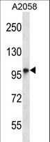 TMC6 Antibody - TMC6 Antibody western blot of A2058 cell line lysates (35 ug/lane). The TMC6 antibody detected the TMC6 protein (arrow).