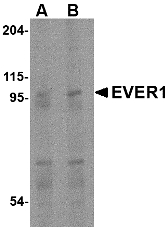 TMC6 Antibody - Western blot of EVER1 in human spleen tissue lysate with EVER1 antibody at (A) 1 and (B) 2 ug/ml.