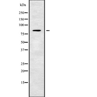 TMC7 Antibody - Western blot analysis of TMC7 using MCF-7 whole cells lysates