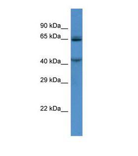 TMC7 Antibody - Western blot of Human HCT15. TMC7 antibody dilution 1.0 ug/ml.  This image was taken for the unconjugated form of this product. Other forms have not been tested.