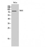 TMC8 / EVER2 Antibody - Western blot of TMC8 antibody