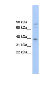 TMC8 / EVER2 Antibody - TMC8 / EVER2 antibody Western blot of 721_B cell lysate. This image was taken for the unconjugated form of this product. Other forms have not been tested.