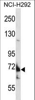 TMC8 / EVER2 Antibody - TMC8 Antibody western blot of NCI-H292 cell line lysates (35 ug/lane). The TMC8 antibody detected the TMC8 protein (arrow).