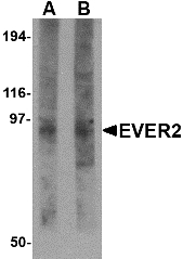TMC8 / EVER2 Antibody - Western blot of EVER2 in rat thymus tissue lysate with EVER2 antibody at (A) 1 and (B) 2 ug/ml.