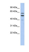 TMCC1 Antibody - TMCC1 antibody Western blot of PANC1 cell lysate. This image was taken for the unconjugated form of this product. Other forms have not been tested.