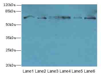TMCC1 Antibody - Western blot. All lanes: TMCC1 antibody at 1 ug/ml. Lane 1: MCF7 whole cell lysate. Lane 2: Mouse liver tissue. Lane 3: Mouse kidney tissue. Lane 4: HL60 whole cell lysate. Lane 5: K562 whole cell lysate. Lane 6: U937 whole cell lysate. Secondary Goat polyclonal to Rabbit IgG at 1:10000 dilution. Predicted band size: 72 kDa. Observed band size: 72 kDa.
