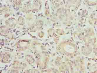 TMCC1 Antibody - Immunohistochemistry of paraffin-embedded human salivary gland tissue using antibody at dilution of 1:100.