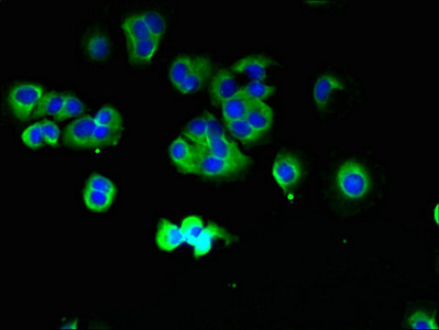 TMCC1 Antibody - Immunofluorescent analysis of MCF-7 cells using TMCC1 Antibody at dilution of 1:100 and Alexa Fluor 488-congugated AffiniPure Goat Anti-Rabbit IgG(H+L)
