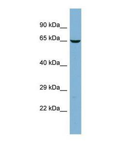 TMCC2 Antibody - Western blot of Human PANC1. TMCC2 antibody dilution 1.0 ug/ml.  This image was taken for the unconjugated form of this product. Other forms have not been tested.