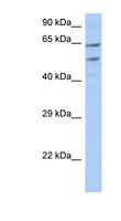 TMCC3 Antibody - TMCC3 antibody Western blot of OVCAR-3 cell lysate. This image was taken for the unconjugated form of this product. Other forms have not been tested.