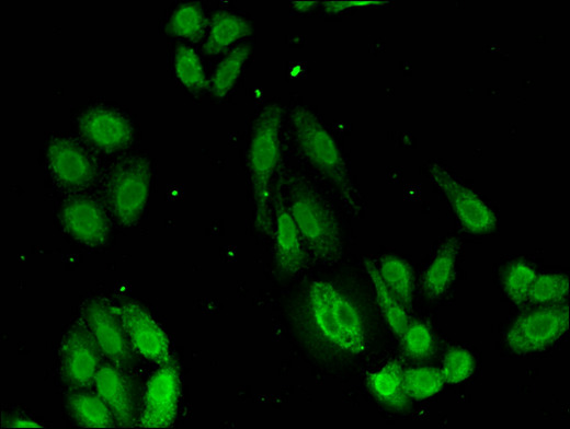 TMCO1 Antibody - Immunofluorescent analysis of HepG2 cells using TMCO1 Antibody at a dilution of 1:100 and Alexa Fluor 488-congugated AffiniPure Goat Anti-Rabbit IgG(H+L)
