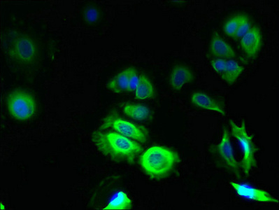TMCO5A Antibody - Immunofluorescent analysis of MCF-7 cells using TMCO5A Antibody at dilution of 1:100 and Alexa Fluor 488-congugated AffiniPure Goat Anti-Rabbit IgG(H+L)