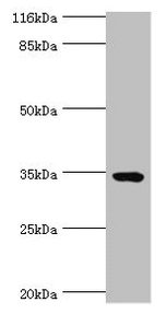TMCO5A Antibody - Western blot All lanes: TMCO5A antibody at 6µg/ml + MCF-7 whole cell lysate Secondary Goat polyclonal to rabbit IgG at 1/10000 dilution Predicted band size: 35, 27 kDa Observed band size: 35 kDa