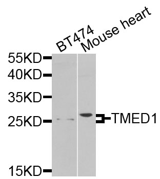 TMED1 / ST2L Antibody - Western blot analysis of extracts of various cells.