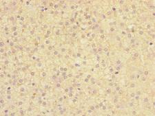 TMED1 / ST2L Antibody - Immunohistochemistry of paraffin-embedded human adrenal gland tissue at dilution 1:100