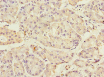 TMED1 / ST2L Antibody - Immunohistochemistry of paraffin-embedded human pancreatic tissue at dilution 1:100