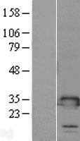 TMED1 / ST2L Protein - Western validation with an anti-DDK antibody * L: Control HEK293 lysate R: Over-expression lysate