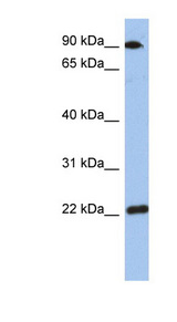 TMED10 / TMP21 Antibody - TMED10 / TMP21 antibody Western blot of Fetal Small Intestine lysate. This image was taken for the unconjugated form of this product. Other forms have not been tested.