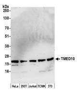 TMED10 / TMP21 Antibody - Detection of human and mouse TMED10 by western blot. Samples: Whole cell lysate (15 µg) from HeLa, HEK293T, Jurkat, mouse TCMK-1, and mouse NIH 3T3 cells prepared using NETN lysis buffer. Antibody: Affinity purified rabbit anti-TMED10 antibody used for WB at 0.1 µg/ml. Detection: Chemiluminescence with an exposure time of 3 minutes.