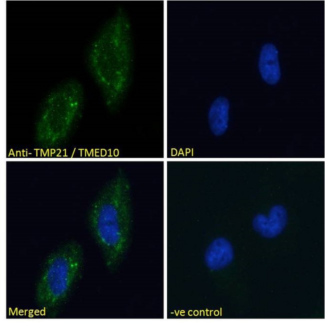 TMED10 / TMP21 Antibody - TMED10 / TMP21 antibody immunofluorescence analysis of paraformaldehyde fixed U251 cells, permeabilized with 0.15% Triton. Primary incubation 1hr (10ug/ml) followed by Alexa Fluor 488 secondary antibody (2ug/ml), showing Golgi/cytoplasmic staining. The nuclear stain is DAPI (blue). Negative control: Unimmunized goat IgG (10ug/ml) followed by Alexa Fluor 488 secondary antibody (2ug/ml).