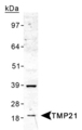 TMED10 / TMP21 Antibody - Detection of TMP21 in human liver lysate.  This image was taken for the unconjugated form of this product. Other forms have not been tested.