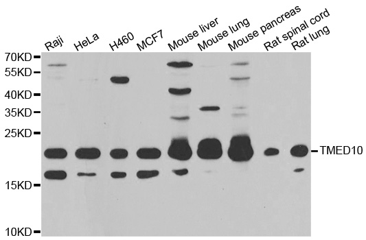 TMED10 / TMP21 Antibody - Western blot analysis of extracts of various cell lines.